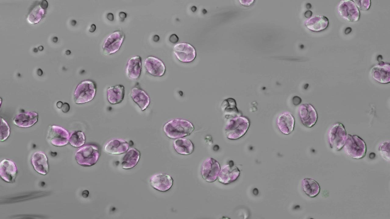 En bild från ett mikroskop med runda, lila figurer och mindre grå.