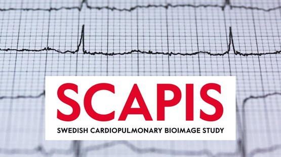 Frequency image of ekg with SCAPIS logo in the foreground