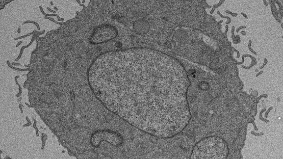 Electron microscopy image of a cell