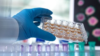 Hand som håller en platta med prover