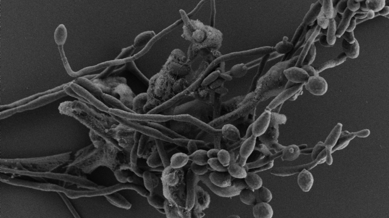 Candida albicans
